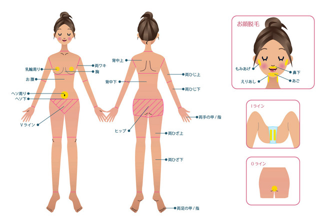 脱毛できる部位